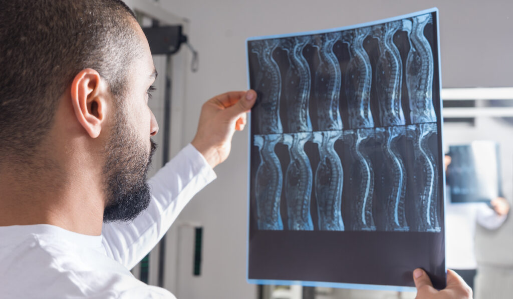 X-Ray image