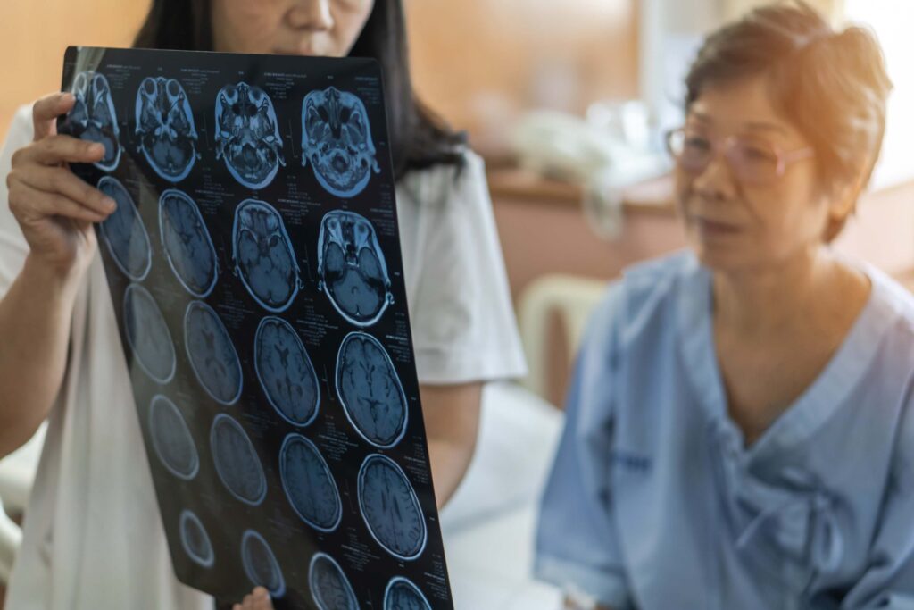 Diagnosis of brain disease with a doctor diagnosing