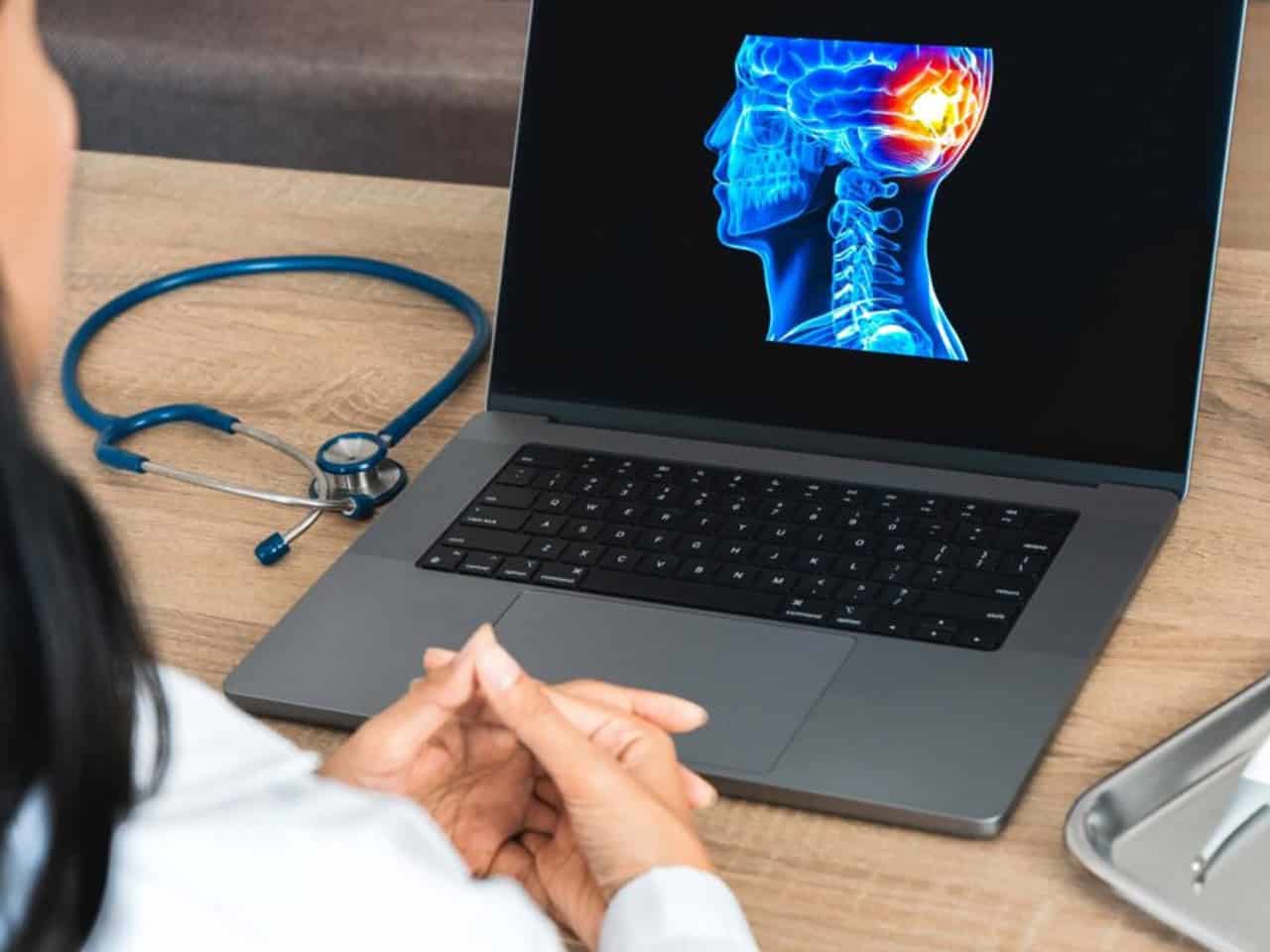 Doctor review brain injury