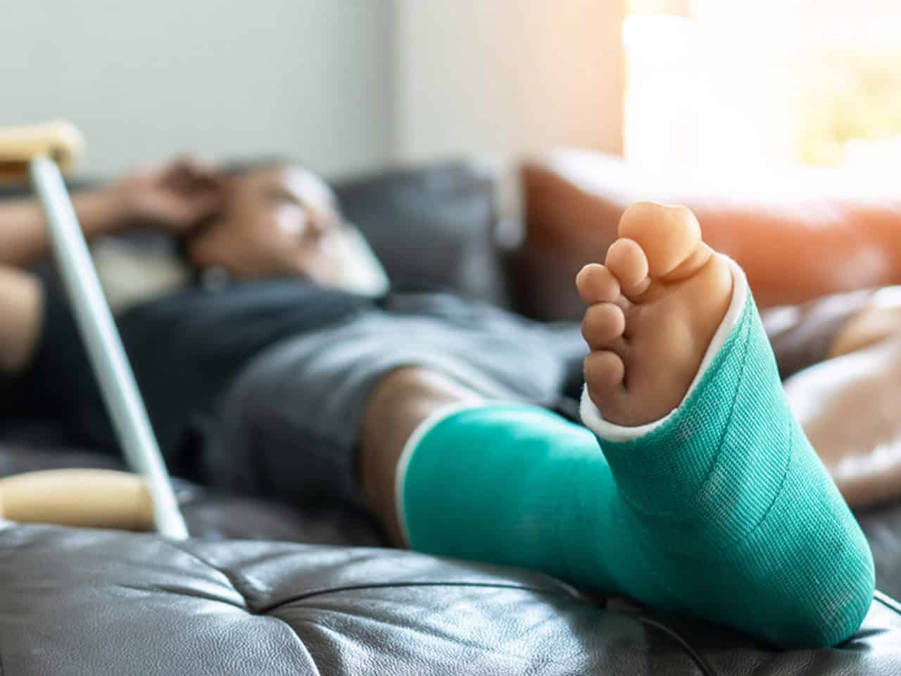 Person in a cast with broken leg